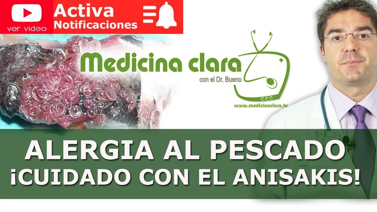 se puede comer pescado con anisakis