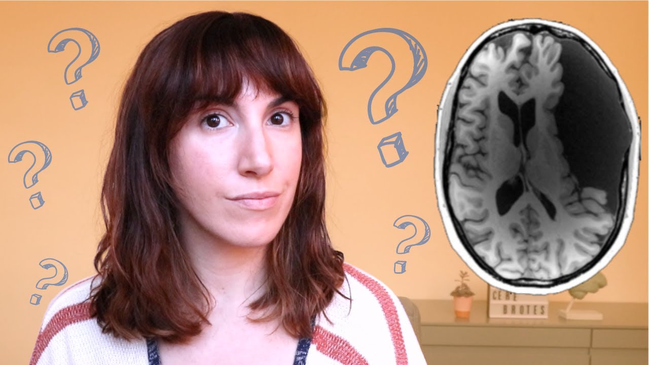 se puede vivir con la mitad del cuerpo