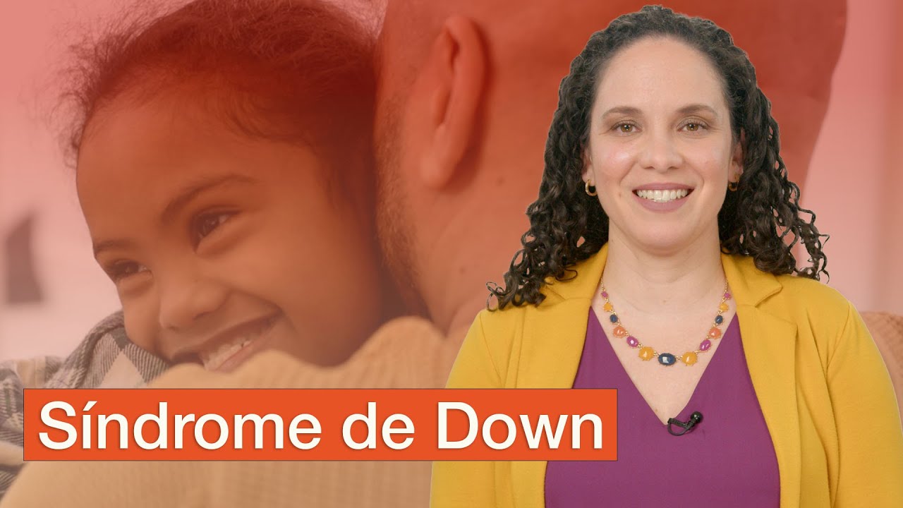 que grado de discapacidad tiene un síndrome de down