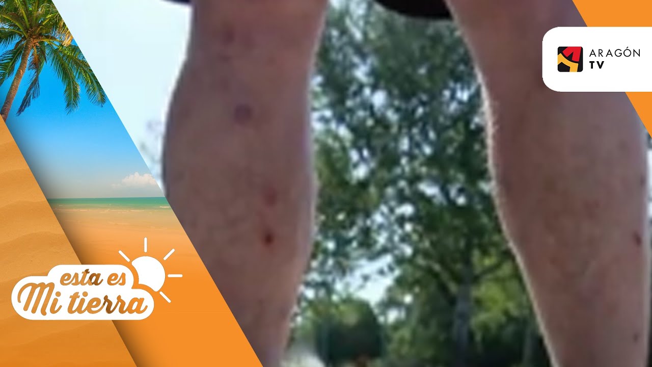 diferencia picadura mosquito y mosquito tigre