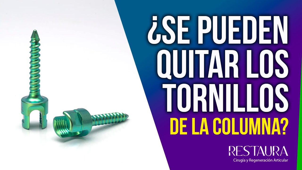 síntomas de rechazo de tornillos en columna